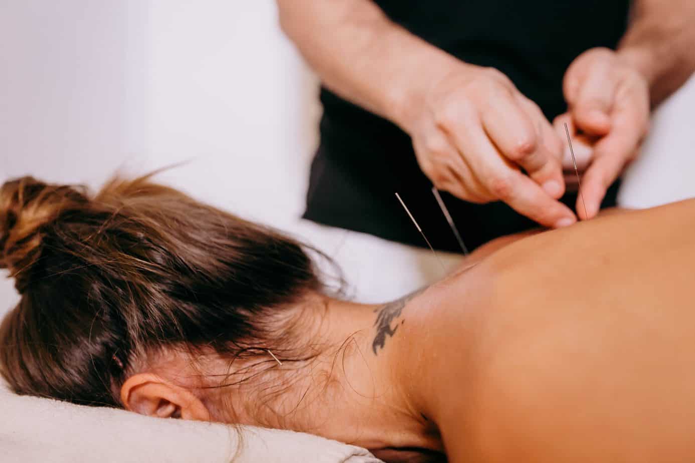 Acupuncture pour l'insomnie : que dit la médecine traditionnelle chinoise